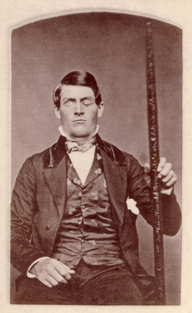 the case study of phineas gage